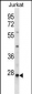 HTATIP2 Antibody (N-term)